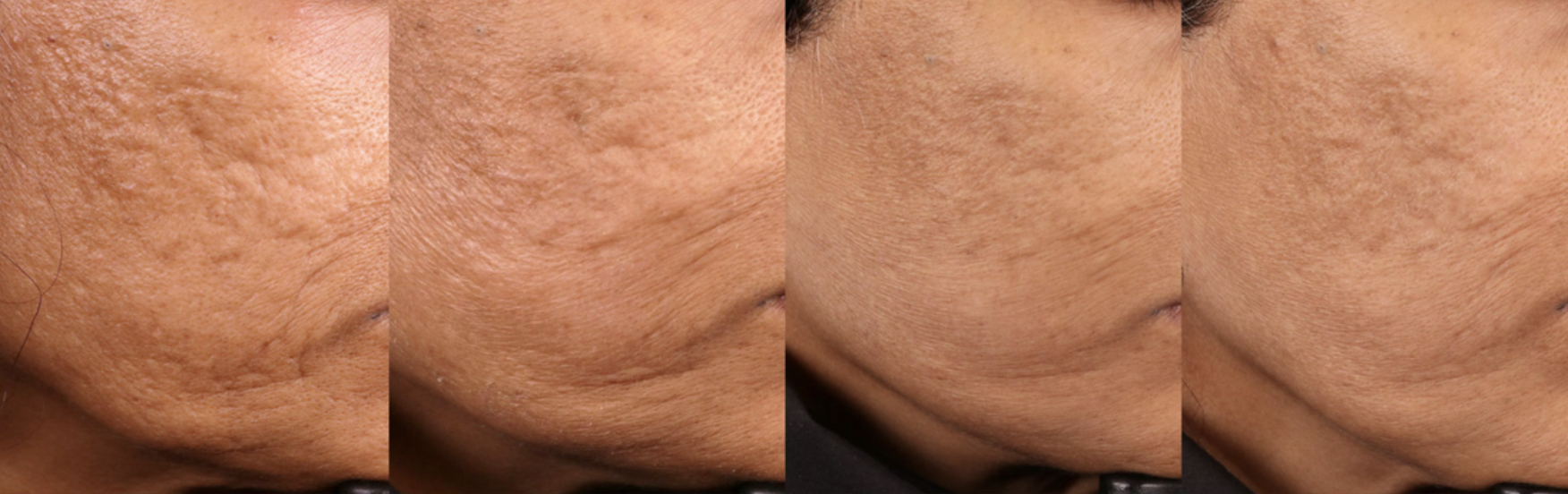 Tendencias belleza 2024